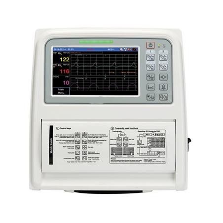 Monitor fetal gemelar